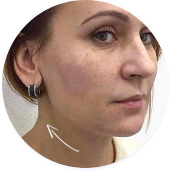 face-better
